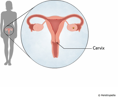 illustration of cervix - Menstrupedia