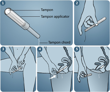 How to use a tampon?