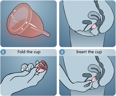 Illustration of menstrual cup, menstrual cup worn in the vagina, step 1: folding the menstrual cup, step 2: inserting the folded menstrual cup - Menstrupedia