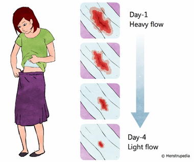Illustration of a girl looking inside her skirt to find if her periods have arrived, to her side are four panels showing the amount of blood flow in first four days of menstruation - Menstrupedia